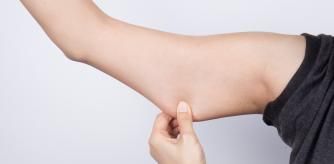 Una persona con flacidez en los brazos.