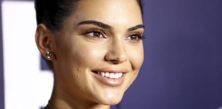 La modelo Kendall Jenner&nbsp;ha mostrado sus problemas de acné en muchas ocasiones