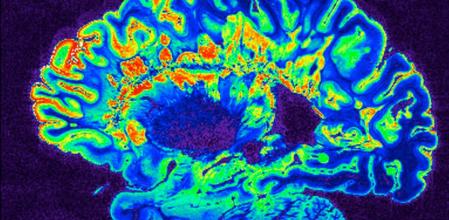 Govind Bhagavatheeshwaran, Daniel Reich, National Institute of Neurological Disorders and Stroke, National Institutes of Health