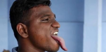 La prominente lengua de este joven que va camino de récord Guinness: casi 11 centímetros de largo