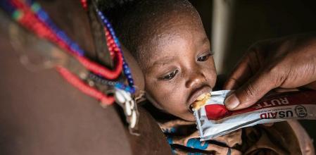 One of Loyna Ares' malnourished twins eats his ready-to-use therapeutic food (RUTF). Loyna Ares (35) is a mother of twin boys (7 months) and five more children. She is treating her malnourished twins at a UNICEF-supported health post in Southern Ethiopia. “We lost all our livestock and our farm respectively because of the drought and the flood,” says Loyna. “We had nothing to eat, so we had to move to the nearest Internally Displaced People (IDP) camp at Lomosia kebele (area) to survive. I was very worried about my twin babies because they look sick and very weak. I couldn’t breasfeed them properly as I was not eating enough myself.” “I suspected that my twins were malnourished,” explains Loyna “but I was unable to cross the river because of the flooding. Health worker Kidist found us at my Sorghum farm. She did a screening [using MUAC bracelet] and found that my babies were severely malnourished. If she hadn't found us, my babies would probably have died. She gave Plumpy Nut and Vitamin A to my babies and therapeutic milk for me,” remembers Loyna. “Now my babies are in better condition.”