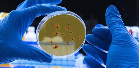 Científico examina el virus del dengue en placa de petri en laboratorio