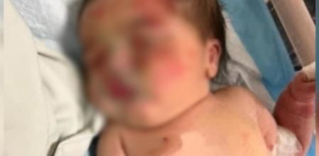 La bebé, con muestras de violencia en su cara