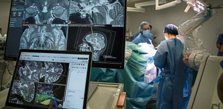 Primera Intervención robótica para una cefalea de racimo en Hospital del Mar. perforación craneal para introducir el dispositivo . Quirófano, operación robotizada, cirujanas, mujeres sanitarias.