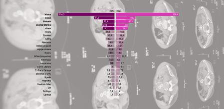 Las cifras del cáncer