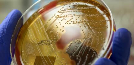 Cómo hacer frente a las superbacterias, una pandemia que causa miles de muertes