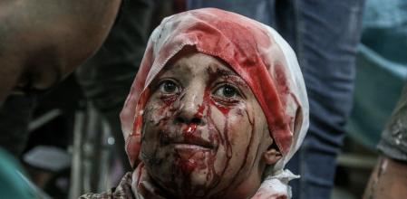 (EDITORS NOTE: Image contains graphic content.) An injured Palestinian child at Al-Aqsa Martyrs Hospital following an Israeli airstrike on the Rufaida al-Aslamia school in Deir Al-balah, Gaza, on Thursday, Oct. 10, 2024. The US is pressing Israel to limit its response against Iran to military targets. Photographer: Ahmad Salem/Bloomberg