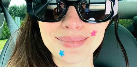 Anne Hathaway con los parches para granitos