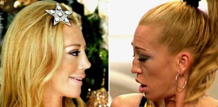 El rostro de Belén Esteban ha sufrido múltiples intervenciones quirúrgicas. Una de las más sonadas es esta que reproducimos en la que se retocó la nariz, los pómulos y el óvalo -el antes y el después- que le hizo copar la portada de algunas publicaciones rosa