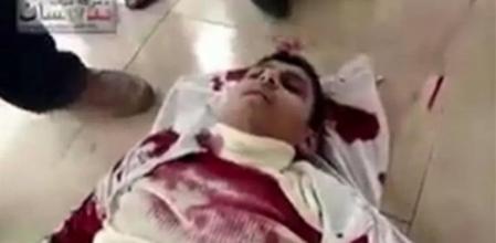 La agencia Afp confirma que la captura de esta imagen pertenece a una de las víctimas de la represión en Siria en Barzeh, Azraa y Banias, aunque no se puede precisar la fecha. El vídeo fue subido al portal de internet el 22 de abril.