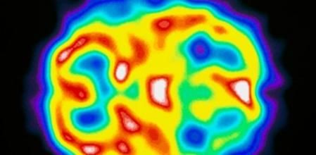 El cerebro envejece por áreas, en función del uso que se les dé