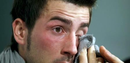 El futbolista Miki Roqué anunció en marzo de 2011 que padecía un tumor en la pelvis