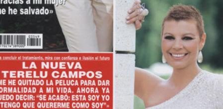 Terelu Campos, sin peluca, en la portada de '¡Hola!'