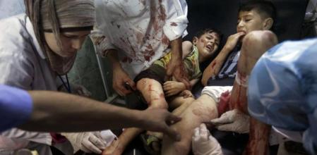 Niños heridos por los bombardeos de Alepo en el hospital Deir Shifa, del barrio de Al Shaar, esta semana