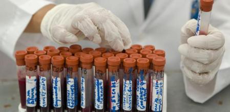 Detalle de pruebas para la detección del sida (VIH).