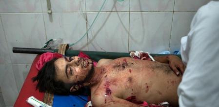 Un herido en el bombardeo de Ariha