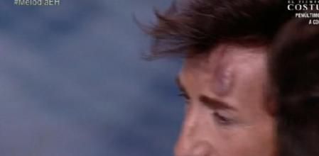 El presentador se golpeó la cabeza con una anilla de hierro durante una prueba, que le causó un enorme chichón