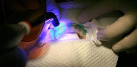 La salud de las encías, mucho más importante de lo que se cree