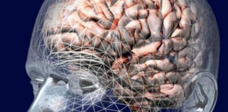 Imagen de un cerebro