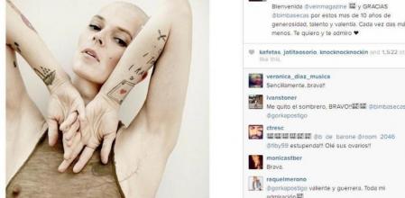 Foto de Bimba Bosé en la que muestra la masectomía a la que fue sometida a principios de año