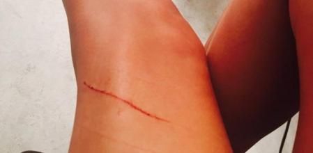 Taylor Swift comparte una imagen en Instagram con un arañazo en una pierna