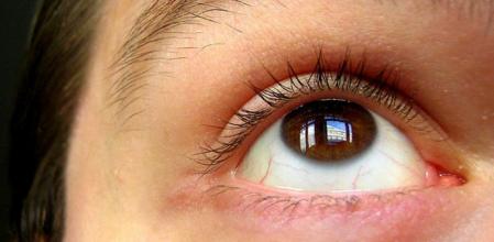 La alergia ocular puede provocar una inflamación de los párpados, de la conjuntiva o de la córnea