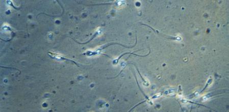 Imagen de semen utilizado en una inseminación artificia