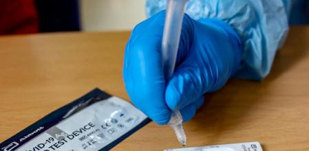 La realización de un test de antígenos solo está autorizado al personal sanitario.&nbsp;