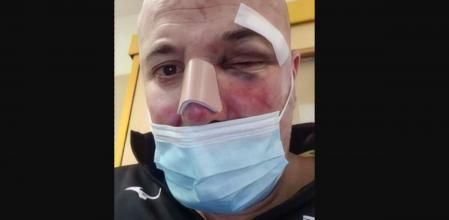 Así quedó el hombre agredido por dos policías en Linares