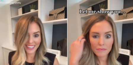 La 'influencer' ha mostrado en TikTok el resultado de su última intervención estética