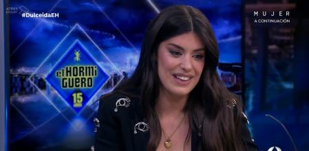 Dulceida desvela su curioso defecto corporal en 'El hormiguero'