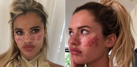 La influencer australiana Tilly Whitfield ha querido alertar sobre los peligros de no confiar en profesionales.