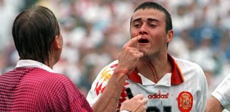 Luis Enrique, sangrando tras el codazo de Tassotti