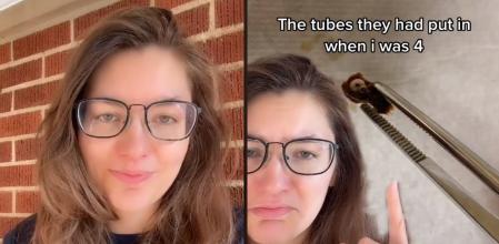 ¿Te imaginas vivir con eso más de dos décadas sin saberlo?