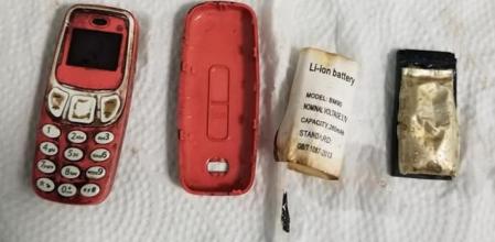 L_Va al hospital por fuertes dolores de estómago y descubre que se ha tragado un Nokia 3310