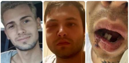 Algunas de las personas que han sufrido en las últimas fechas la homofobia, llegando incluso una de ellas, Samuel Luiz, a perder la vida