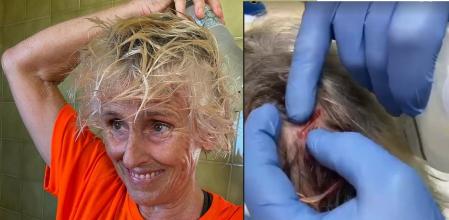 Mercedes Milá sufrió un aparatoso accidente mientras iba en bicicleta.