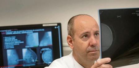 Javier Cortes, experto en cancer de mama en Teknon