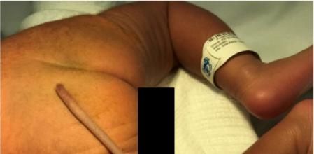 Es un caso muy extraño