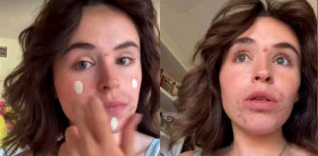 Este es el truco definitivo para camuflar las rojeces que está arrasando en TikTok