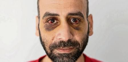 Youssef Atallah, a migrant from Syria, who says he was beaten by the Belarusian border guards, stands in the centre for migrants in Bialystok, Poland, November 10, 2021. REUTERS/Marko Djurica TPX IMAGES OF THE DAY