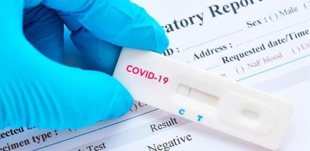 Se disparan los contagios por covid en Andalucía.