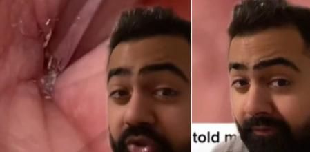 El médico explica que las consecuencias pueden ser fatales si no cuidamos la higiene de la zona