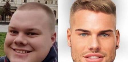 Gasta 30.000 euros en retoques estéticos por ‘culpa’ de Instagram: “La perfección no existe”