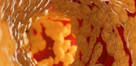 Imagen virtual del interior de una arteria con grasa