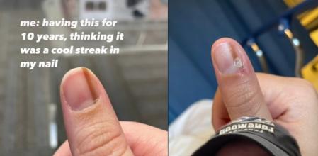 La joven quiere alertar a otros en su misma situación.