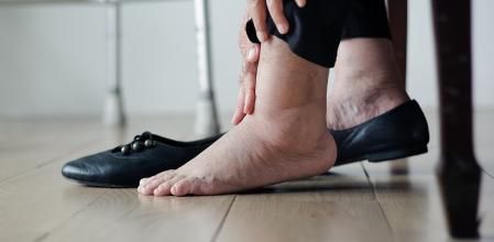 Pies y piernas hinchados