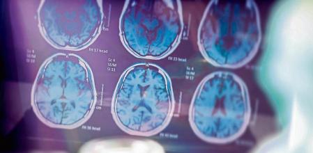 La polución ha irrumpido con fuerza como factor de riesgo