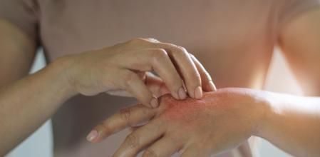 Mujer con hongos en las manos