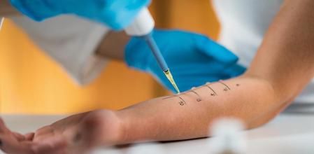 El test de reacciones alérgias en la piel es un procedimiento frecuente para detectar algunos tipos de alergias